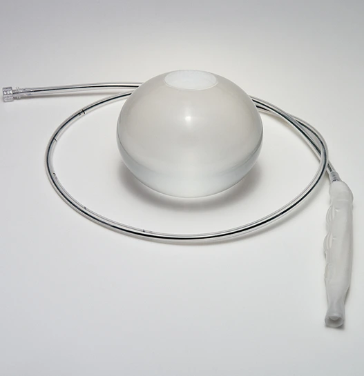 What Is ORBERA™ Gastric Balloon for Weight Loss? Banner